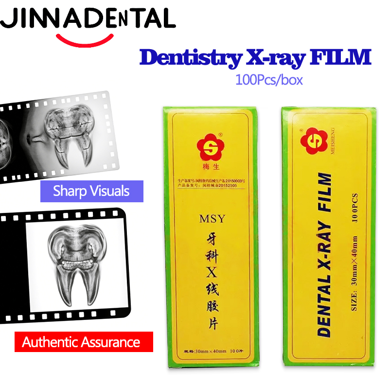30*40mm Tandheelkunde Röntgenf - Medical Lab Images recensie en prijs