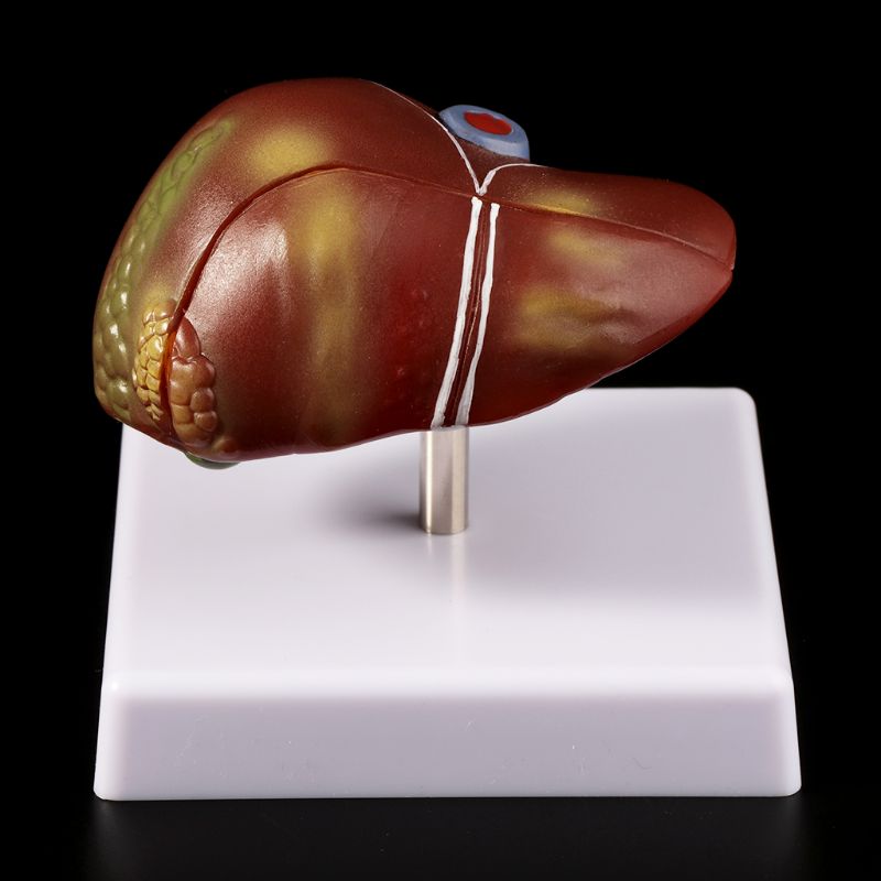 Human Lever Pathologische Anat - Medical Lab Technology recensie en prijs