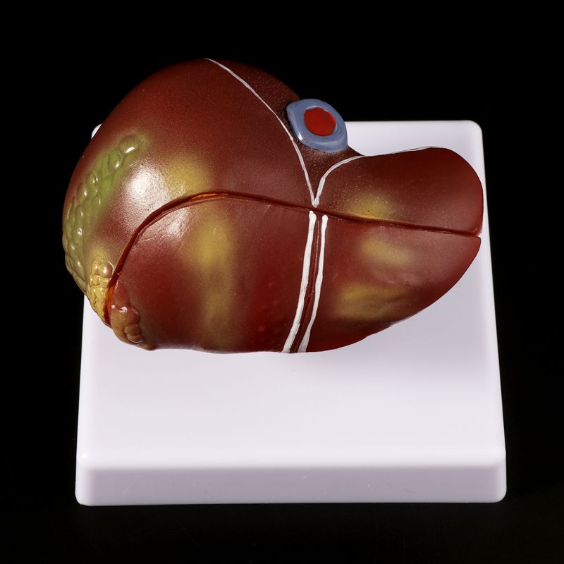 Human Lever Pathologische Anat - Medical Lab Technology recensie en prijs