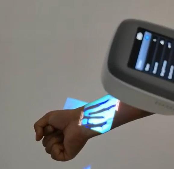 QV-600 Medische aderzoeker met - Medical Lab Images recensie en prijs
