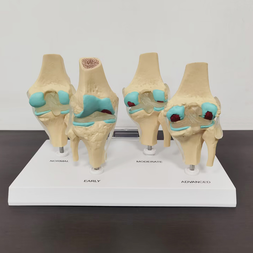 4-Traps Kniegewricht Model Pla - Medical Lab Technology recensie en prijs