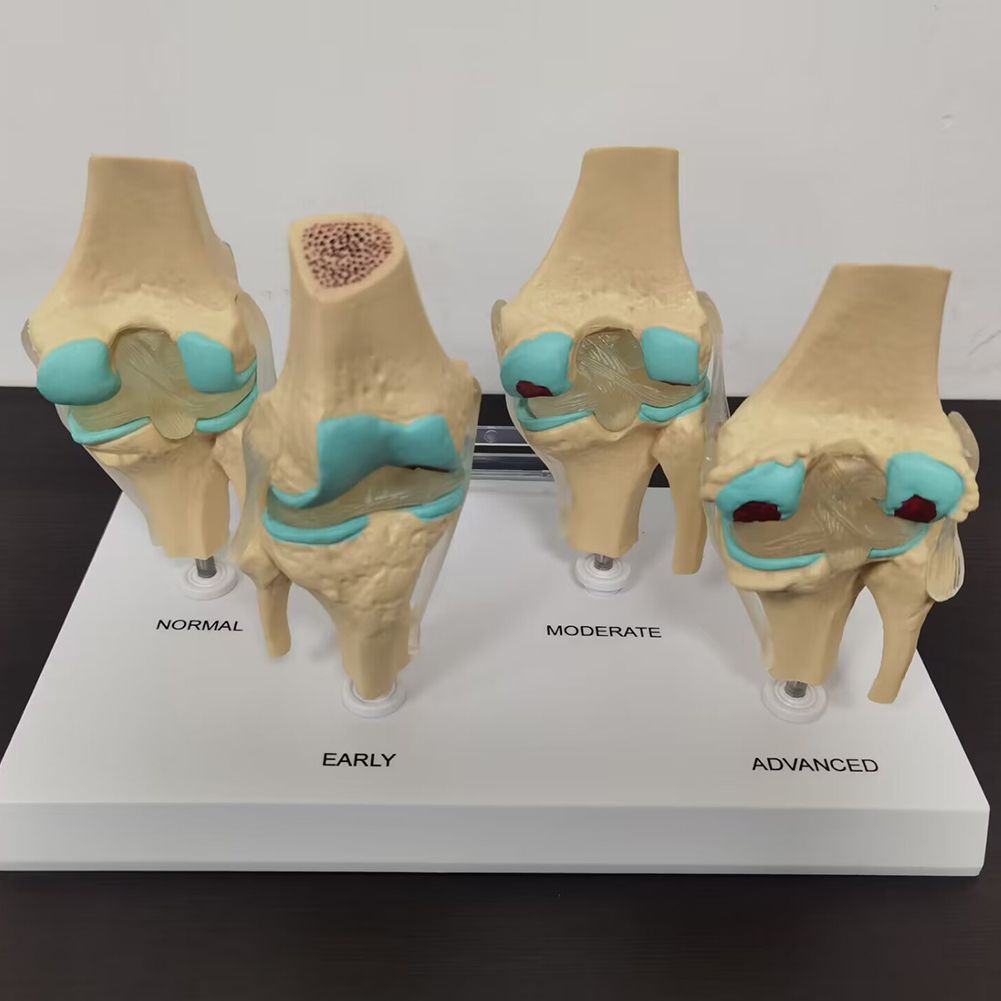 4-Traps Kniegewricht Model Pla - Medical Lab Technology recensie en prijs