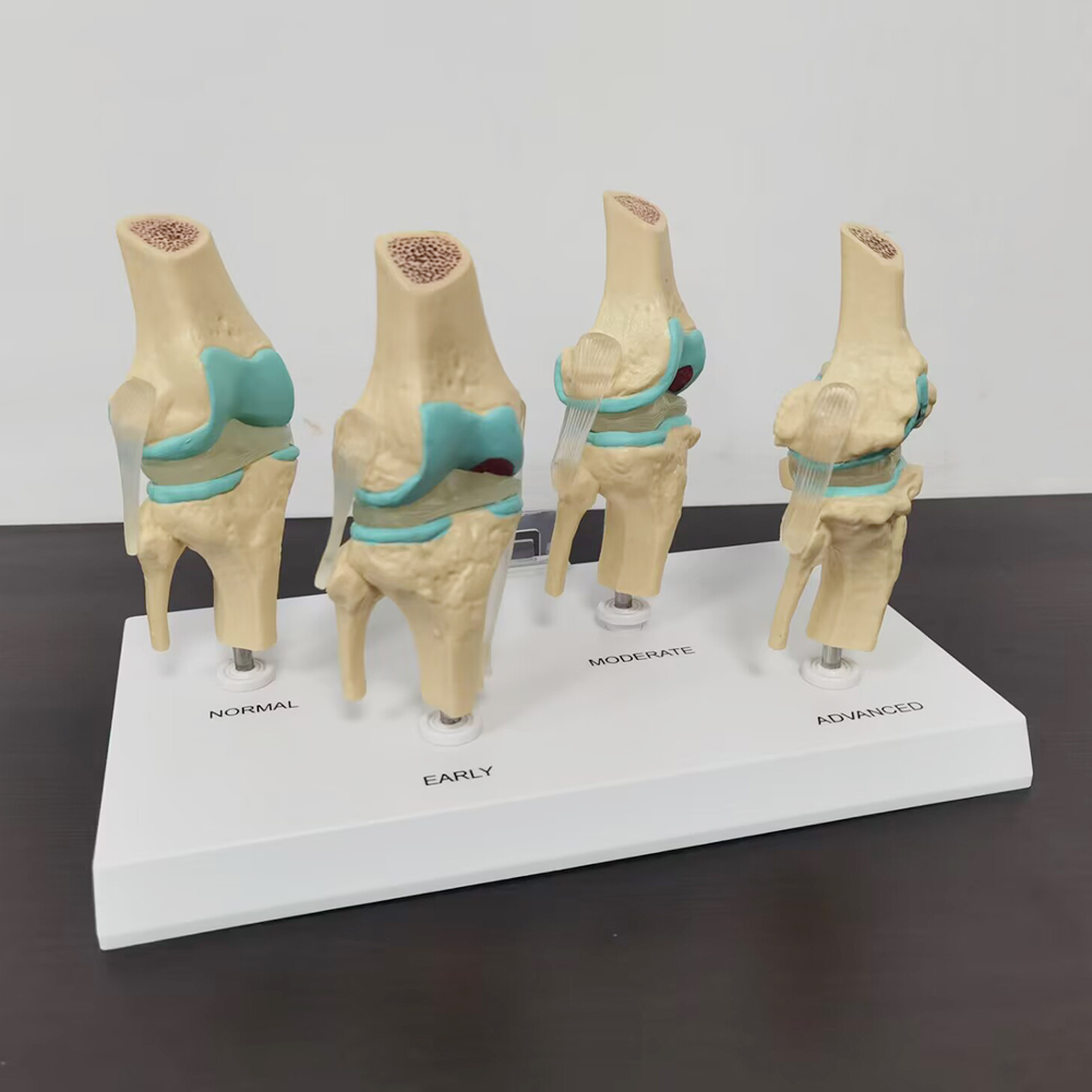 4-Traps Kniegewricht Model Pla - Medical Lab Technology recensie en prijs